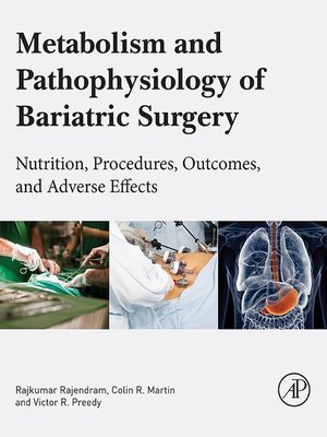 cover image of Metabolism and Pathophysiology of Bariatric Surgery